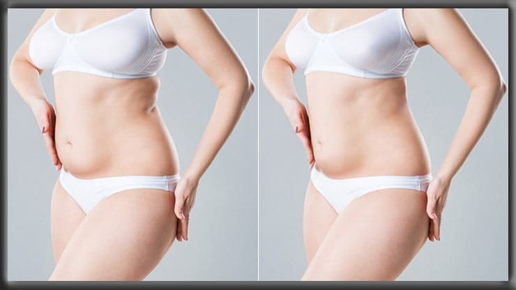 Body Reshaping